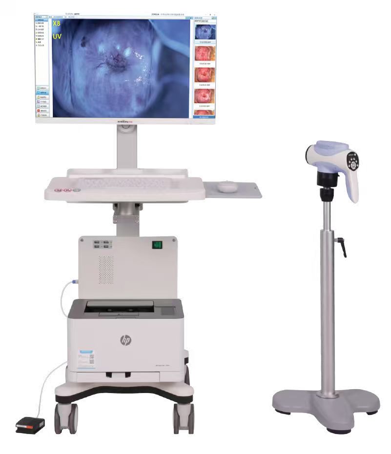 4K60b  电子阴道镜